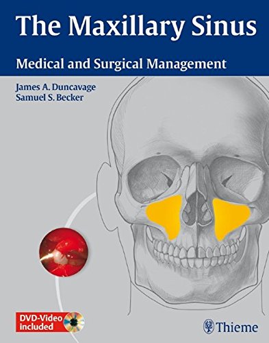 The Maxillary Sinus