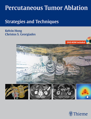 Percutaneous Tumor Ablation