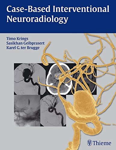 Case-Based Interventional Neuroradiology