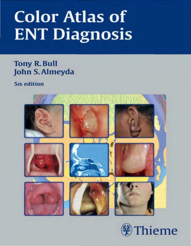 Color Atlas of Ent Diagnosis