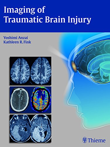 Imaging of traumatic brain injury