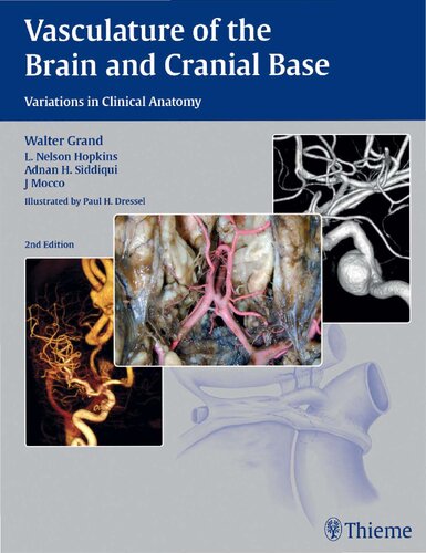 Vasculature of the brain and cranial base : variations in clinical anatomy