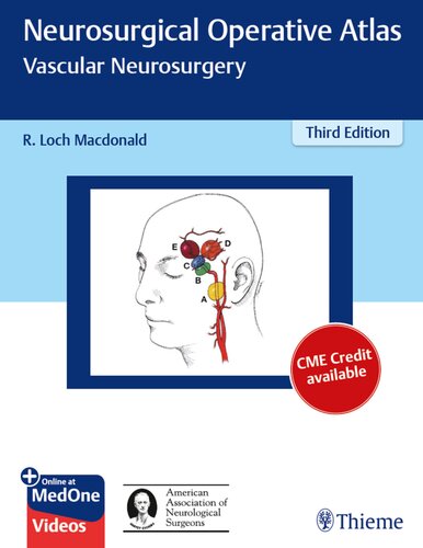 Neurosurgical operative atlas. Vascular neurosurgery