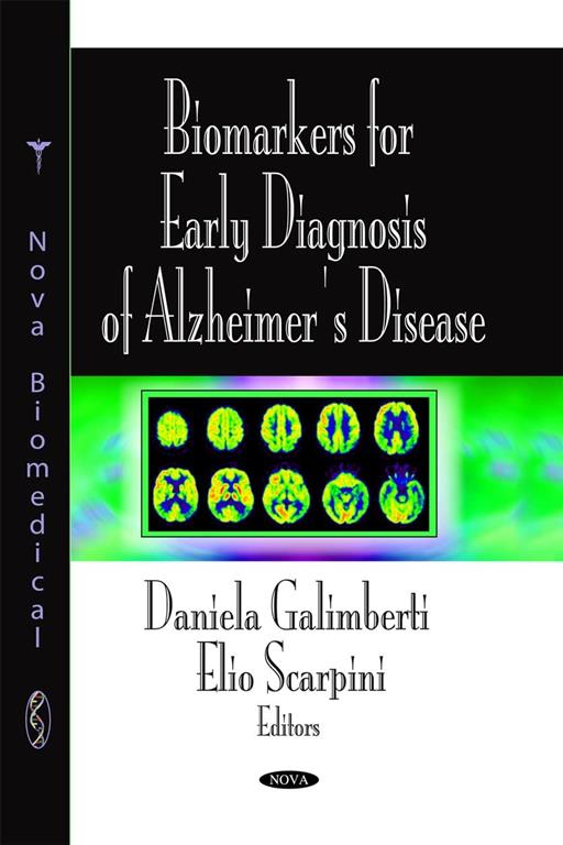 Biomarkers for Early Diagnosis of Alzheimer's Disease