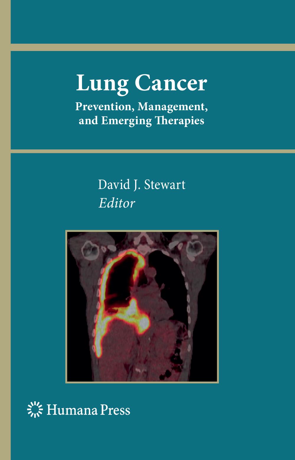 Lung Cancer Prevention, Management, and Emerging Therapies