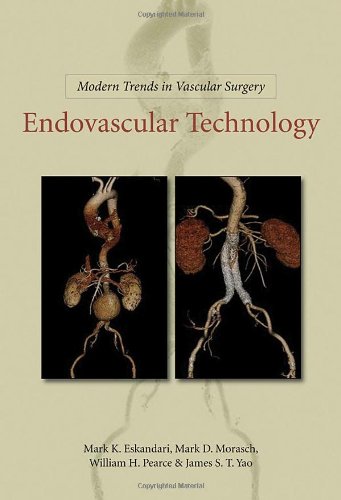 Endovascular Technology (Modern Trends In Vascular Surgery)