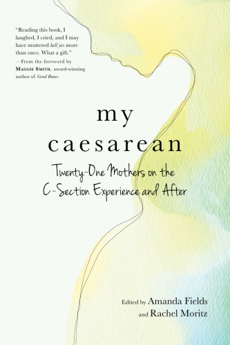 My Caesarean