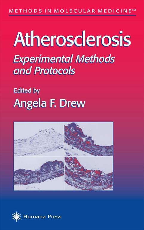 Atherosclerosis: Experimental Methods and Protocols (Methods in Molecular Medicine, 52)