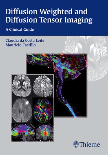 Diffusion weighted and diffusion tensor imaging : a clinical guide