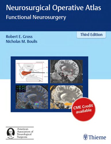 Neurosurgical operative atlas functional neurosurgery