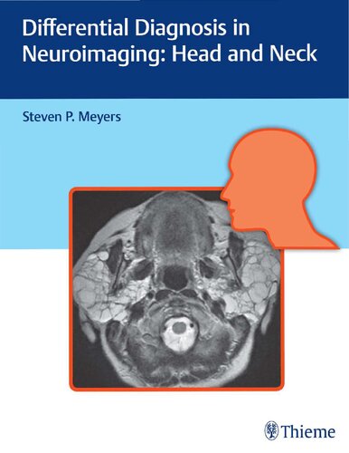 Differential Diagnosis in Neuroimaging