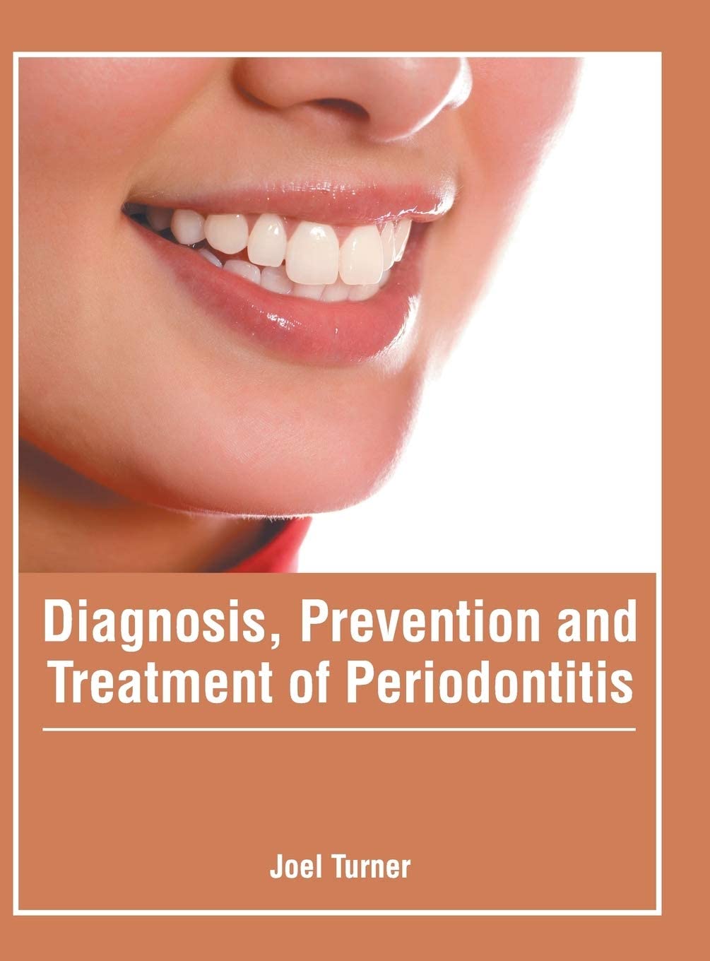Diagnosis, Prevention and Treatment of Periodontitis