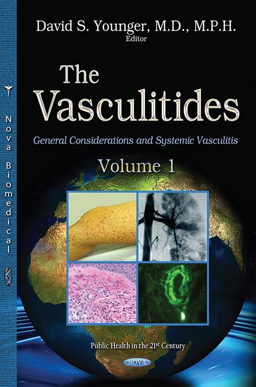 The Vasculitides, Volume 1: General Considerations and Systemic Vasculitis