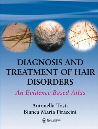 Diagnosis and Treatment of Hair Disorders