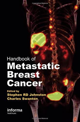 Handbook of Metastatic Breast Cancer