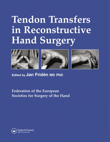 Tendon Transfers in Reconstructive Hand Surgery (Fessh Instructional Coursebooks)