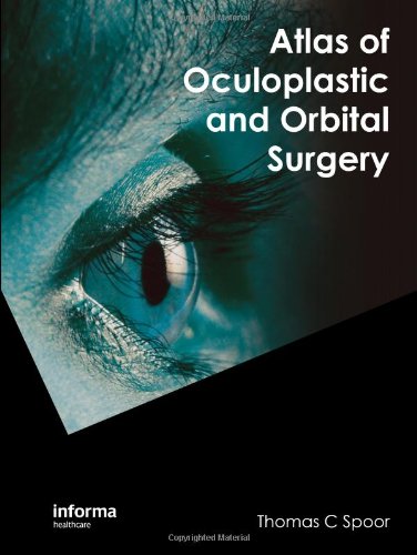 Atlas Of Oculoplastic And Orbital Surgery