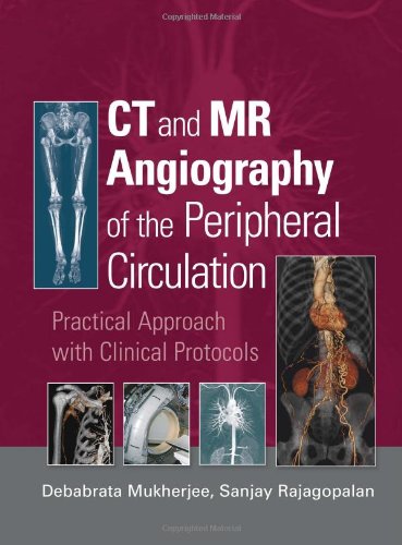 CT and MR Angiography of the Peripheral Circulation