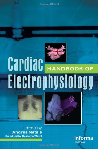 Handbook of Cardiac Electrophysiology