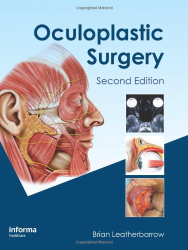 Oculoplastic Surgery