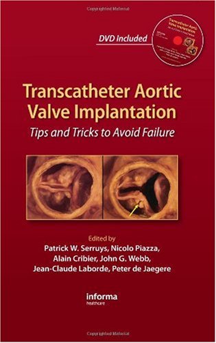 Transcatheter Aortic Valve Implantation