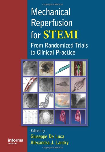 Mechanical Reperfusion for STEMI