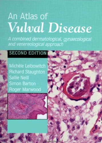 An atlas of vulval disease : a combined dermatological, gynaecological and venereological approach