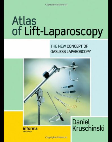 Atlas of Lift-Laparoscopy