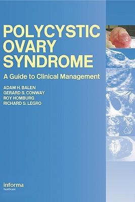 Polycystic Ovary Syndrome