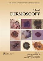 An Atlas Of Dermoscopy (Encyclopedia Of Visual Medicine Series)