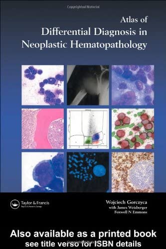 An Atlas of Differential Diagnosis in Neoplastic Hematopathology
