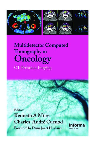 Multi Detector Computed Tomography In Oncology