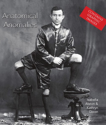 Anatomical anomalies