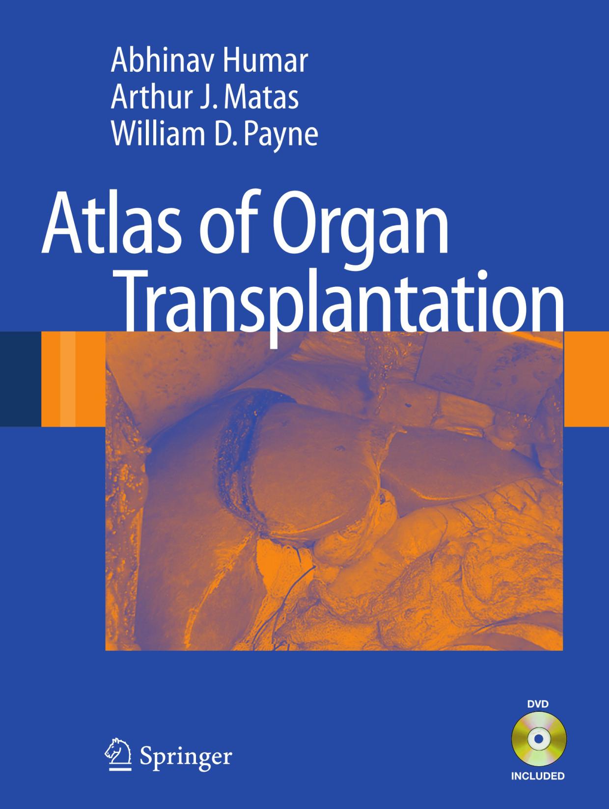 Atlas of Organ Transplantation