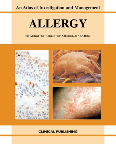 Allergy : an atlas of investigation and management