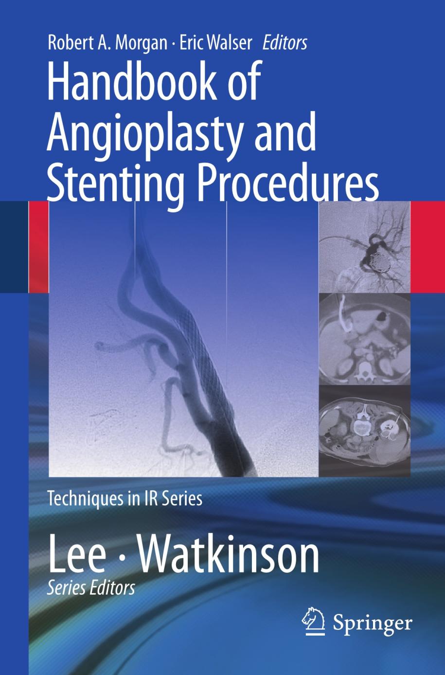 Handbook of Angioplasty and Stenting Procedures