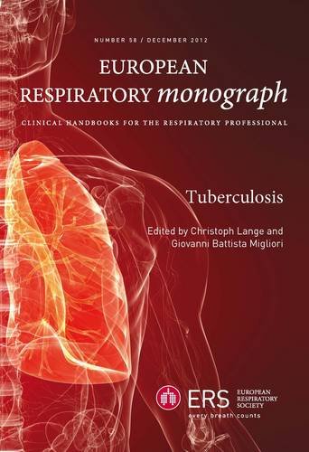 Tuberculosis