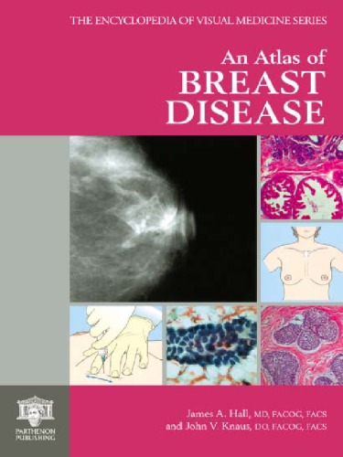 An Atlas of Breast Disease (Encyclopedia of Visual Medicine Series)