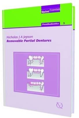 Removable Partial Dentures (Quintessentials of Dental Practice)