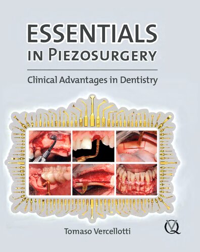 Essentials In Piezosurgery