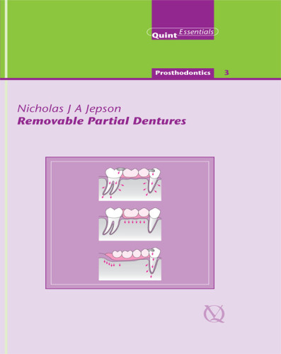 Removable Partial Dentures : QuintEssentials of Dental Practice Vol. 18.