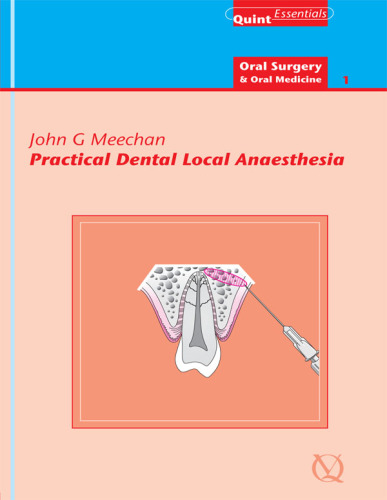 Practical Dental Local Anaesthesia : QuintEssentials of Dental Practice Vol. 6.