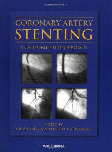 Coronary Artery Stenting