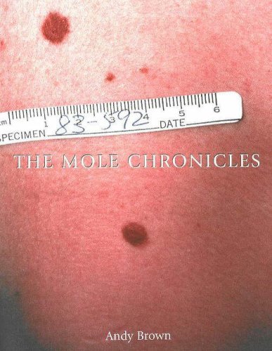 The Mole Chronicles