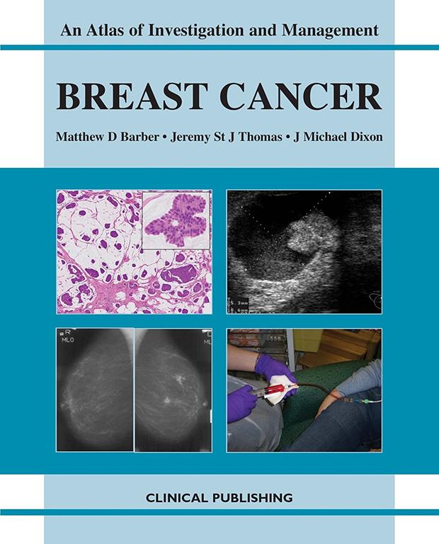 Breast Cancer: An Atlas of Investigation and Management (Atlases of Investigation and Management)