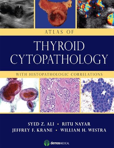 Atlas of Thyroid Cytopathology