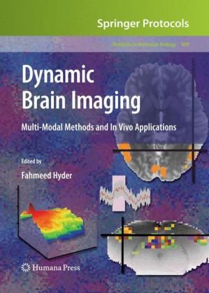 Dynamic Brain Imaging