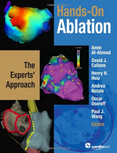 Hands-On Ablation