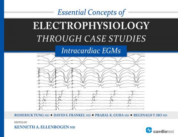 Essential Concepts of Electrophysiology Through Case Studies