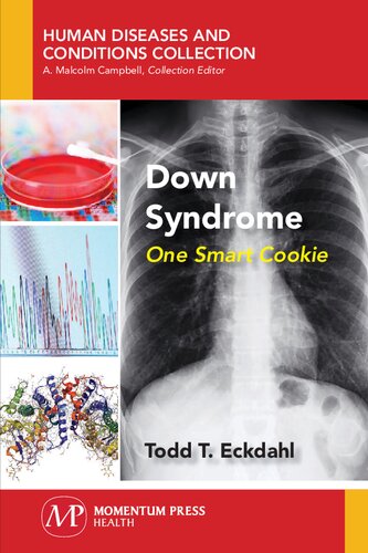 An Extra Chromosome : The Story of down Syndrome.